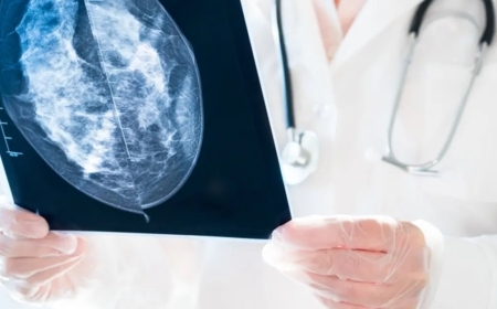 Mamografide 'Kategori 0' Endişesi: Risk Habercisi mi? Uzman Görüşleriyle Açıklıyoruz