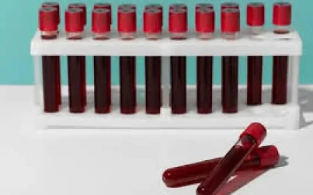 0 Kan Grubu Bireyleri, Sosyal Ortamlardan Kaçınmayı Tercih Ediyor!