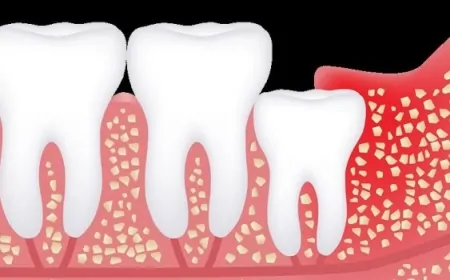 Evrimsel Geçmişimizden Kalan, Artık Gereksiz Olmuş Organlar: Apandisten Yirmilik Dişlere