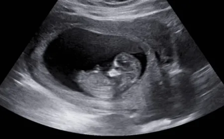 Tarihte Bir İlk: SMA'lı Çocuk, Anne Karnında Tedavi Edildi!