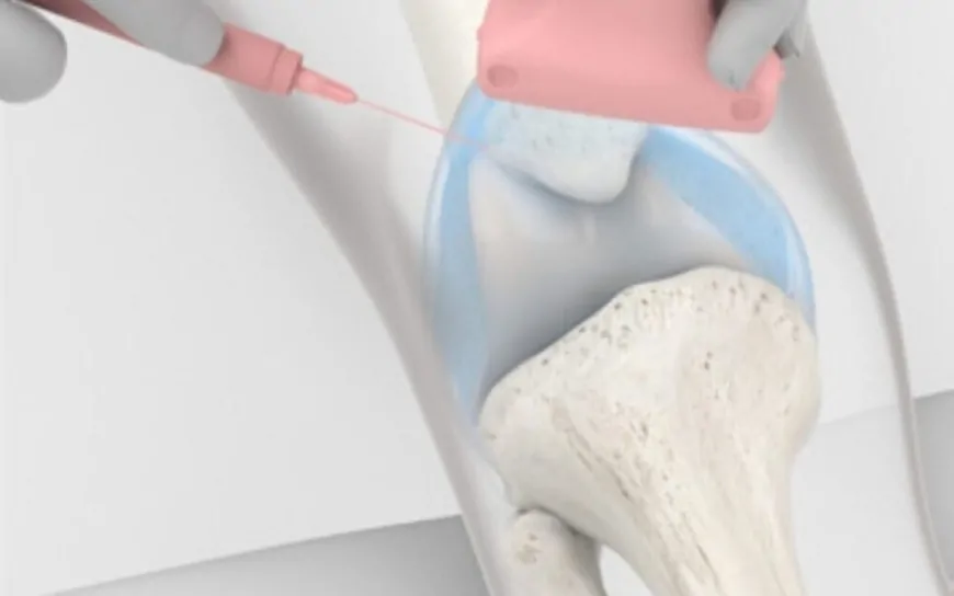 Hidrojel Enjeksiyonu Osteoporoz Tedavisinde Yeni Bir Dönem Başlatabilir