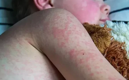 ABD'de kızamıktan ölen çocuğun babası: 'Aşıya güvenmiyoruz'