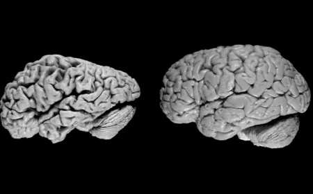 Alzheimer Beyinde Sessizce Başlayıp Ani Yıkımla İlerliyor: İki Evreli Tehlike Ortaya Kondu