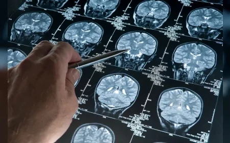 Beyin Tümörü Riski, 30 Saniyelik Basit El Testiyle Belirlenebilir mi?