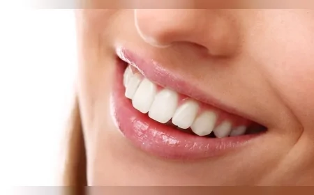 Evde Uygulanabilen Bu Doğal Yöntemle Dişleriniz Kısa Sürede Beyazlayabilir