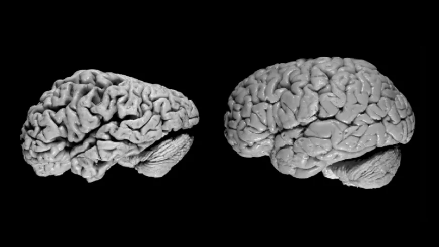 Alzheimer Beyinde Sessizce Başlayıp Ani Yıkımla İlerliyor: İki Evreli Tehlike Ortaya Kondu