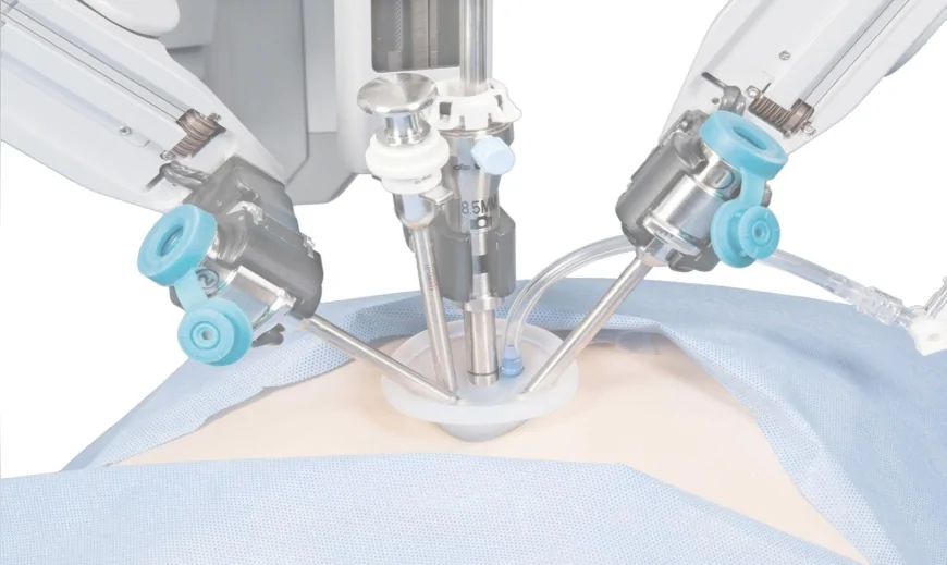 Robotik kollar kansere karşı: Cerrahlar artık ameliyatı oturarak yapıyor