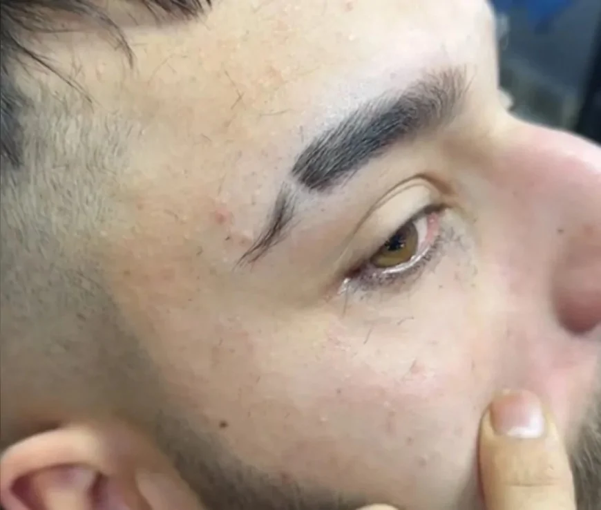 TikTok'ta yayılan kirpik kesme çılgınlığı göz sağlığını tehdit ediyor