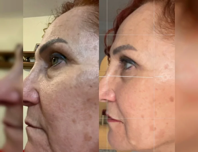 Dokunmadan Gençlik ve Güzellik vaadeden Nuray Kaya 'Pranic Şifa' ile Yüz Germe ve Vücut Şekillendirme yapıyor