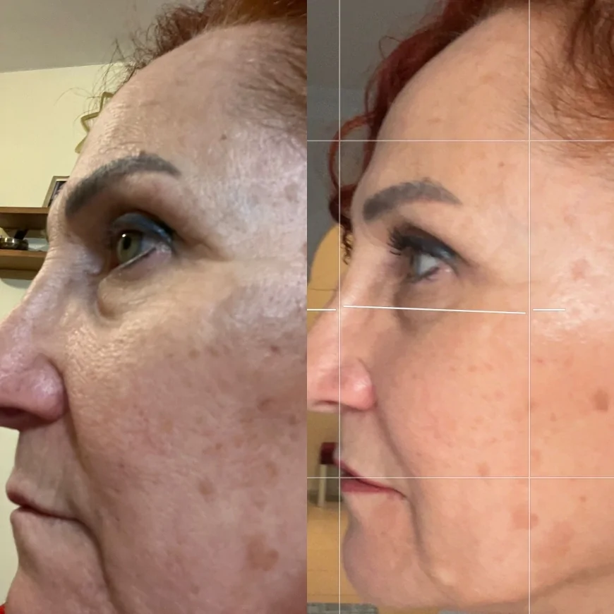 Dokunmadan Gençlik ve Güzellik vaadeden Nuray Kaya 'Pranic Şifa' ile Yüz Germe ve Vücut Şekillendirme yapıyor