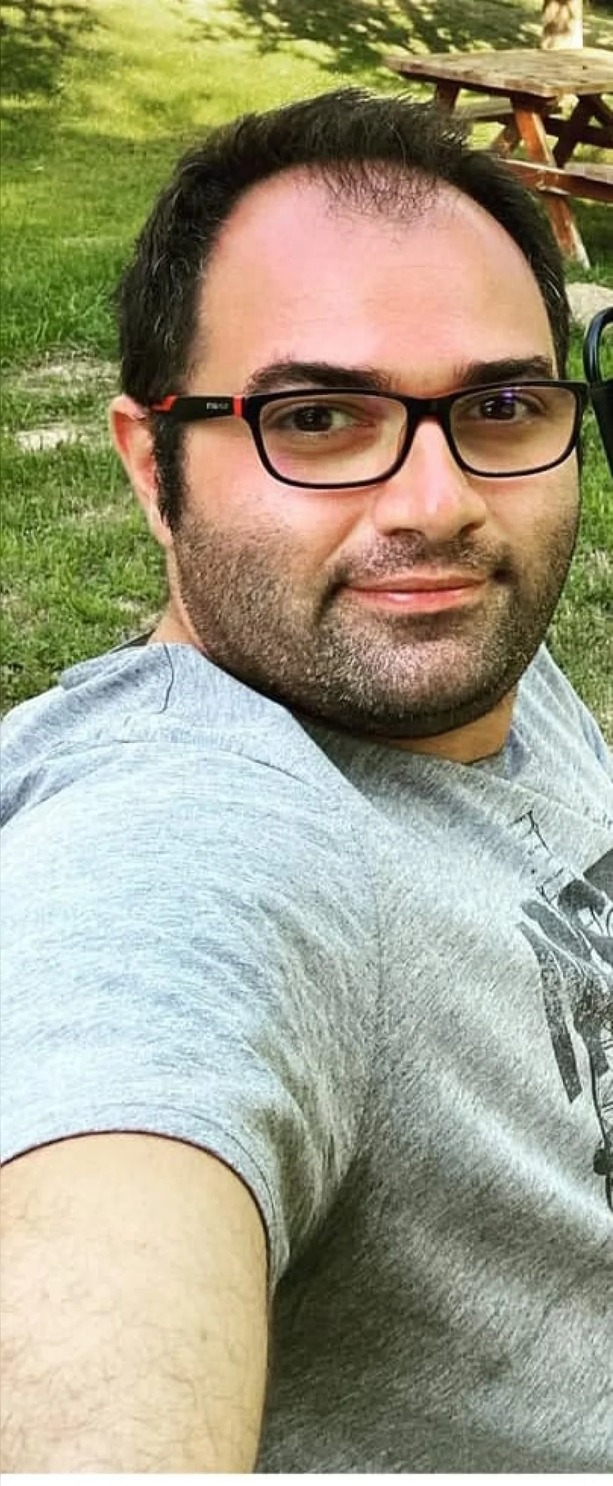 OBEZİTE CERRAHİSİNDE 'ESTETİK' TARTIŞMASI: YAN HASTALIĞI OLAN HASTALAR SİGORTADAN YARARLANAMIYOR, FİYATLAR 30 BİN LİRAYA DAYANDI